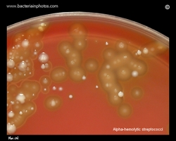alfa hemolytic streptococci.jpg